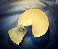 Durability Of Breast Implants